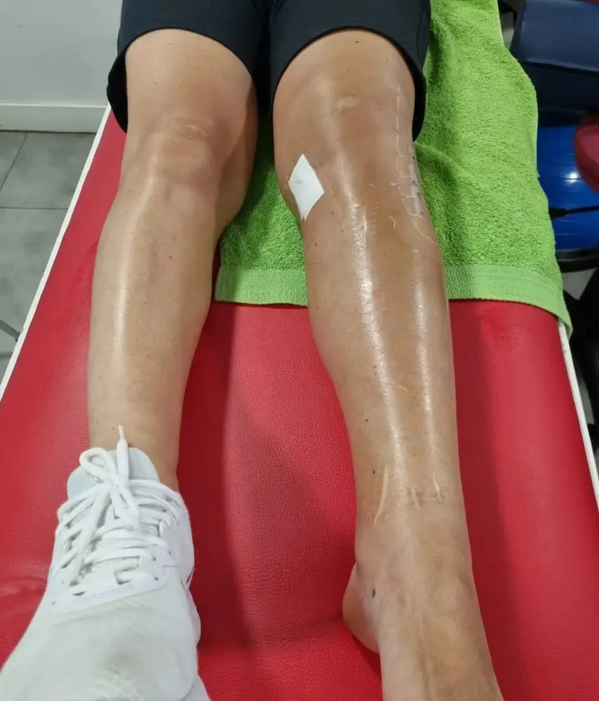 Fisioterapia Traumatológica